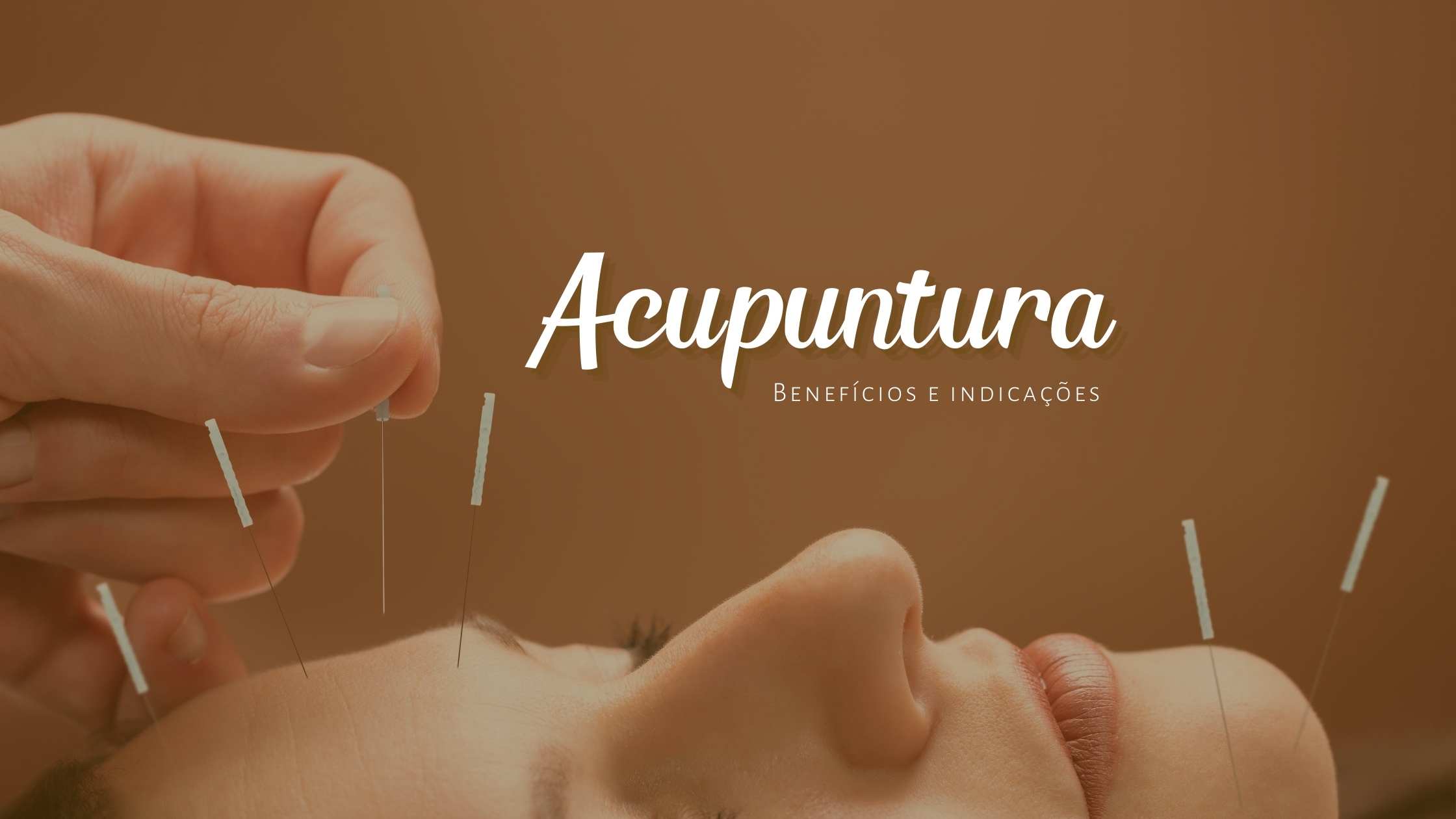 Quais so as principais indicaes e benefcios da acupuntura?